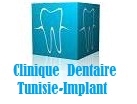 Clinique Dentaire Tunisie Implant