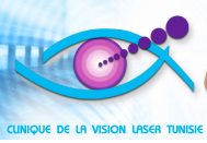  la vision laser 